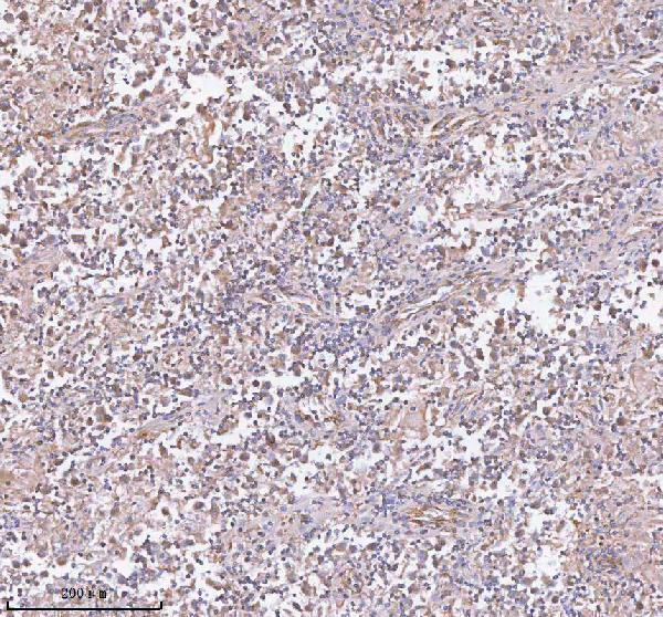 a05507 2 ist1 primary antibodies ihc testing 6