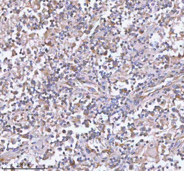 a05507 2 ist1 primary antibodies ihc testing 7
