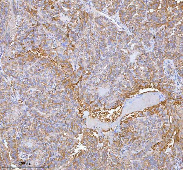 a05507 2 ist1 primary antibodies ihc testing 8