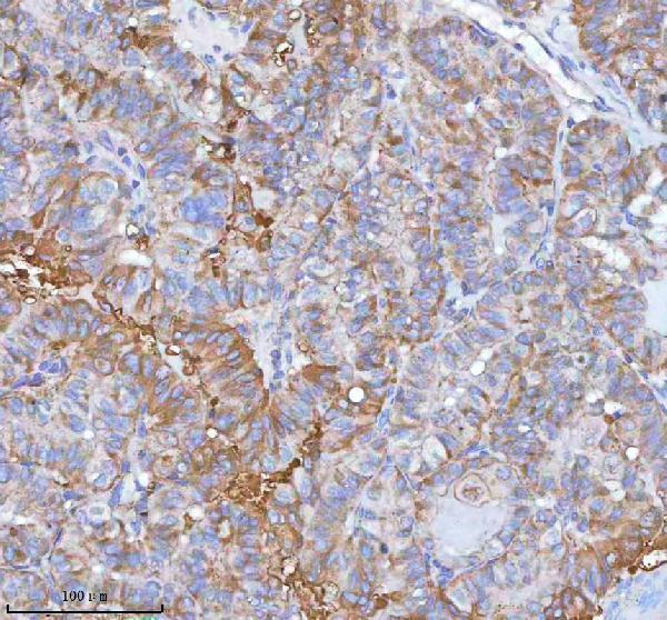 a05507 2 ist1 primary antibodies ihc testing 9
