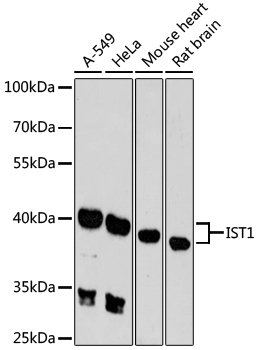 Western blot analysis of extracts of various cell lines, using IST1 antibody  at 1:3000 dilution