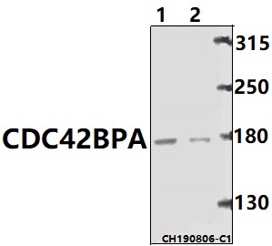 a05509 cdc42bpa primary antiboties wb testing 1