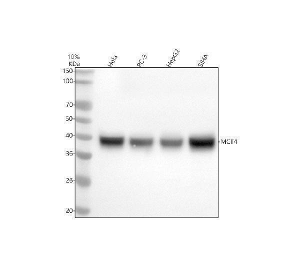  Western blot analysis of MCT4/SLC16A3 using anti-MCT4/SLC16A3 antibody (A05510-2)