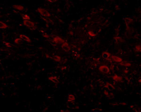 Immunofluorescence of gle1 in mouse brain tissue with gle1 antibody at 5 μg/mL
