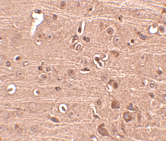 Immunohistochemistry of Gle1 in mouse brain tissue with Gle1 antibody at 2