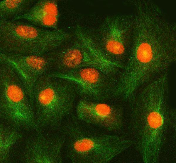 a05519 2 smox primary antibodies if testing 14
