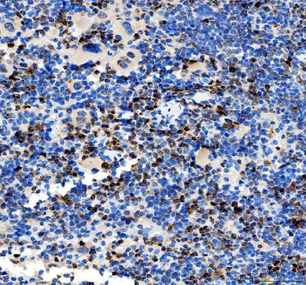 IHC analysis of SMOX using anti-SMOX antibody (A05519-2)