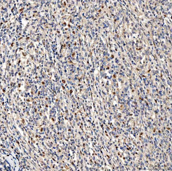  IHC analysis of SMOX using anti-SMOX antibody (A05519-2)