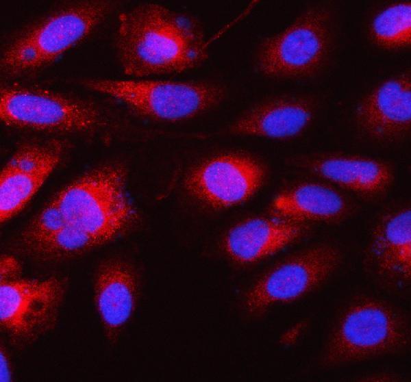 a05520 2 eif4enif1 primary antibodies if testing 1