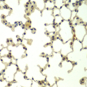 a05523 1 fbxw11 primary antiboties if testing 2