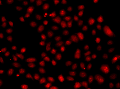 a05523 1 fbxw11 primary antiboties if testing 3