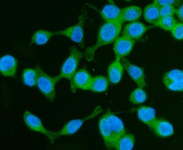 a05530 1 dbn1 primary antibodies if testing 5