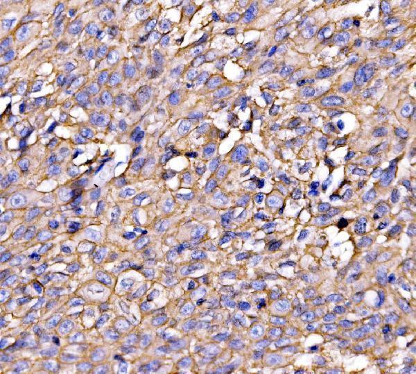  IHC analysis of Drebrin/DBN1 using anti-Drebrin/DBN1 antibody (A05530-1)