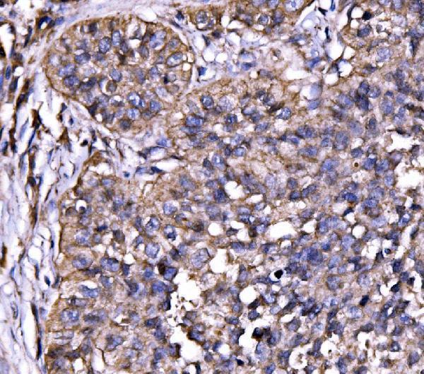 a05530 1 dbn1 primary antibodies ihc testing 3