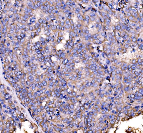 a05530 1 dbn1 primary antibodies ihc testing 4