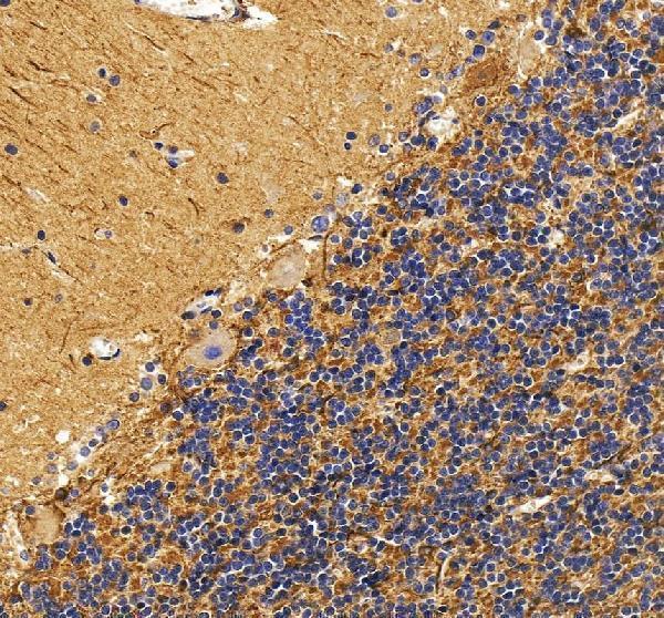 IHC analysis of Drebrin/DBN1 using anti-Drebrin/DBN1 antibody (A05530-1)