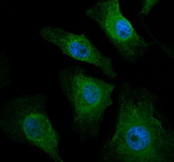 a05531 2 diaph3 primary antibodies if testing 1