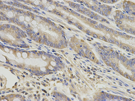 a05532 gnao1 primary antiboties if testing 2