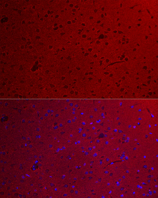 a05532 gnao1 primary antiboties if testing 3