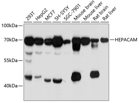 a05533 hepacam primary antiboties wb testing 1