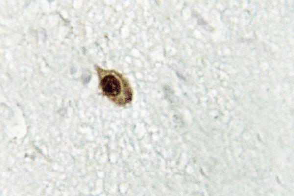 Immunohistochemistry (IHC) analyzes of Zic1/2/3 (D348) pAb in paraffin-embedded human brain tissue