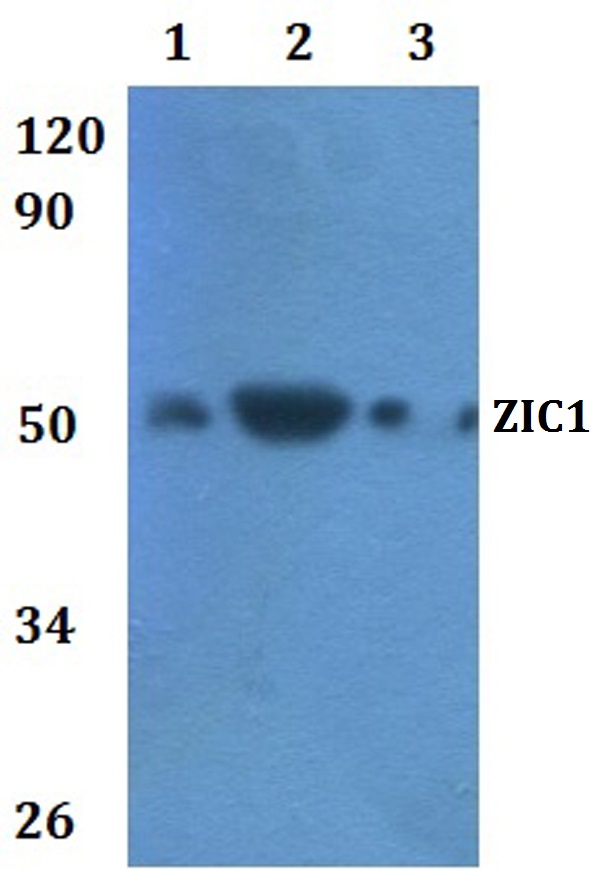 Western blot (WB) analysis of ZIC1 polyclonal antibody at 1:500 dilution  Lane1:HEK293T whole cell lysate
Lane2:RAW264