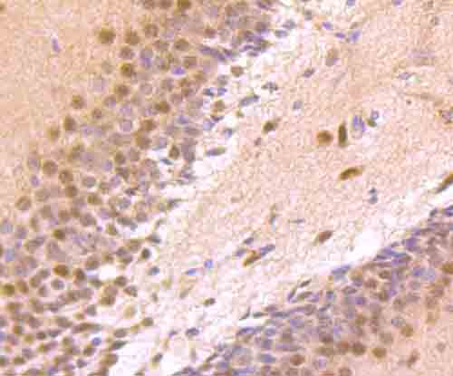 Immunohistochemical analysis of paraffin-embedded rat brain tissue using anti-Zic1 antibody