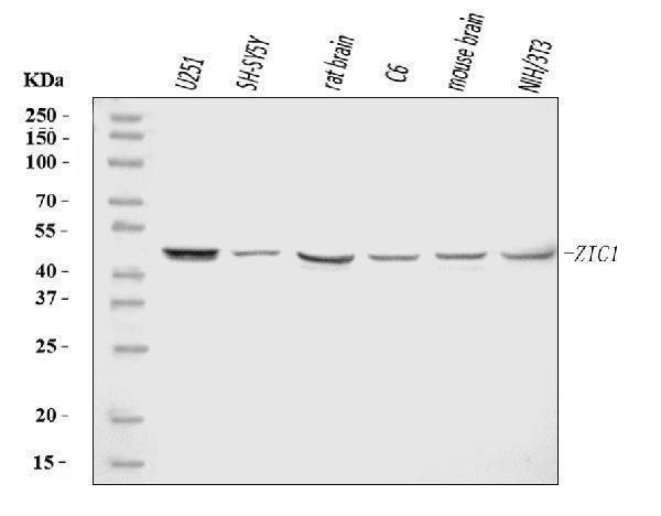  Western blot analysis of ZIC1 using anti-ZIC1 antibody (A05537-4)