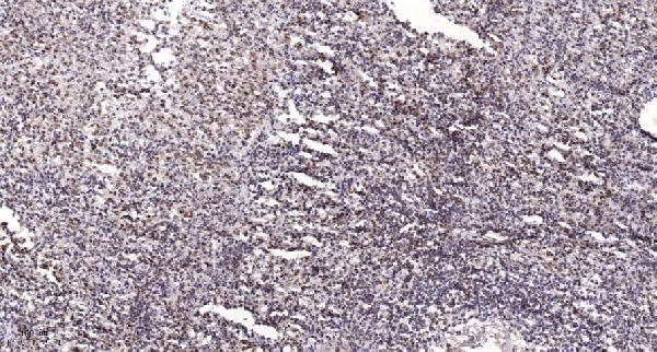Immunohistochemical analysis of paraffin-embedded human spleen