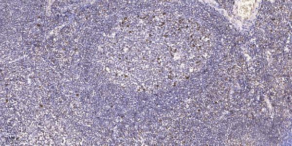 a05545 1 rps6ka4 primary antibodies ihc testing 1