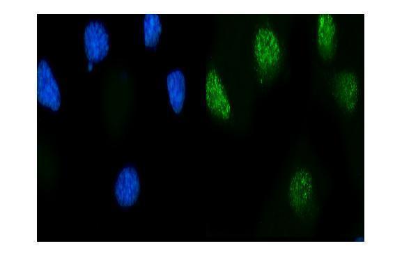 a05545 2 rps6ka4 primary antibodies if testing 9