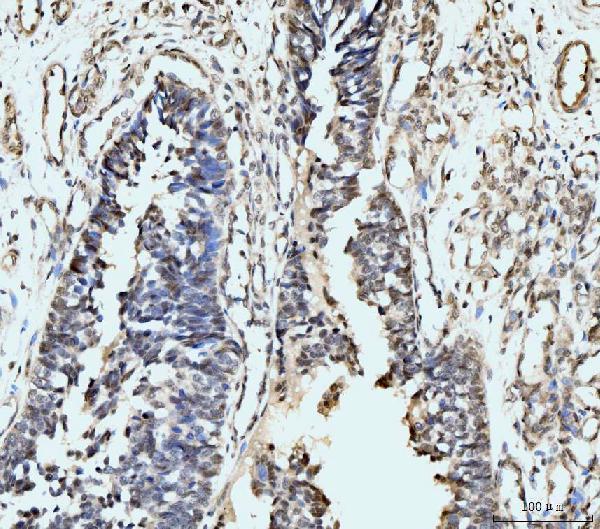  IHC analysis of MSK2/RSK-B/RPS6KA4 using anti-MSK2/RSK-B/RPS6KA4 antibody (A05545-2)