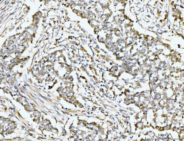  IHC analysis of MSK2/RSK-B/RPS6KA4 using anti-MSK2/RSK-B/RPS6KA4 antibody (A05545-2)