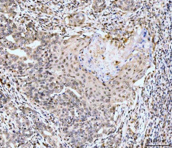 a05545 2 rps6ka4 primary antibodies ihc testing 4