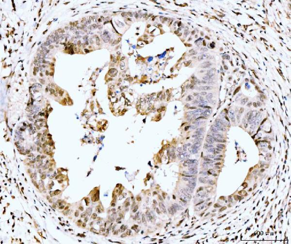 a05545 2 rps6ka4 primary antibodies ihc testing 6