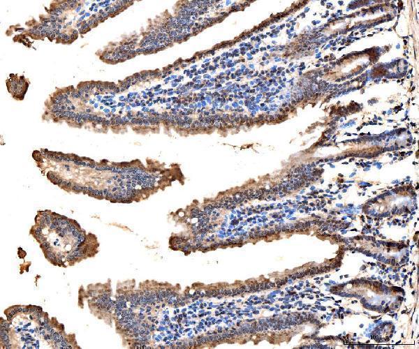 a05545 2 rps6ka4 primary antibodies ihc testing 7