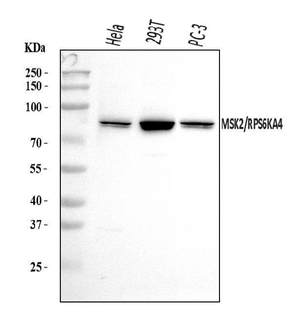  Western blot analysis of MSK2/RSK-B/RPS6KA4 using anti-MSK2/RSK-B/RPS6KA4 antibody (A05545-2)