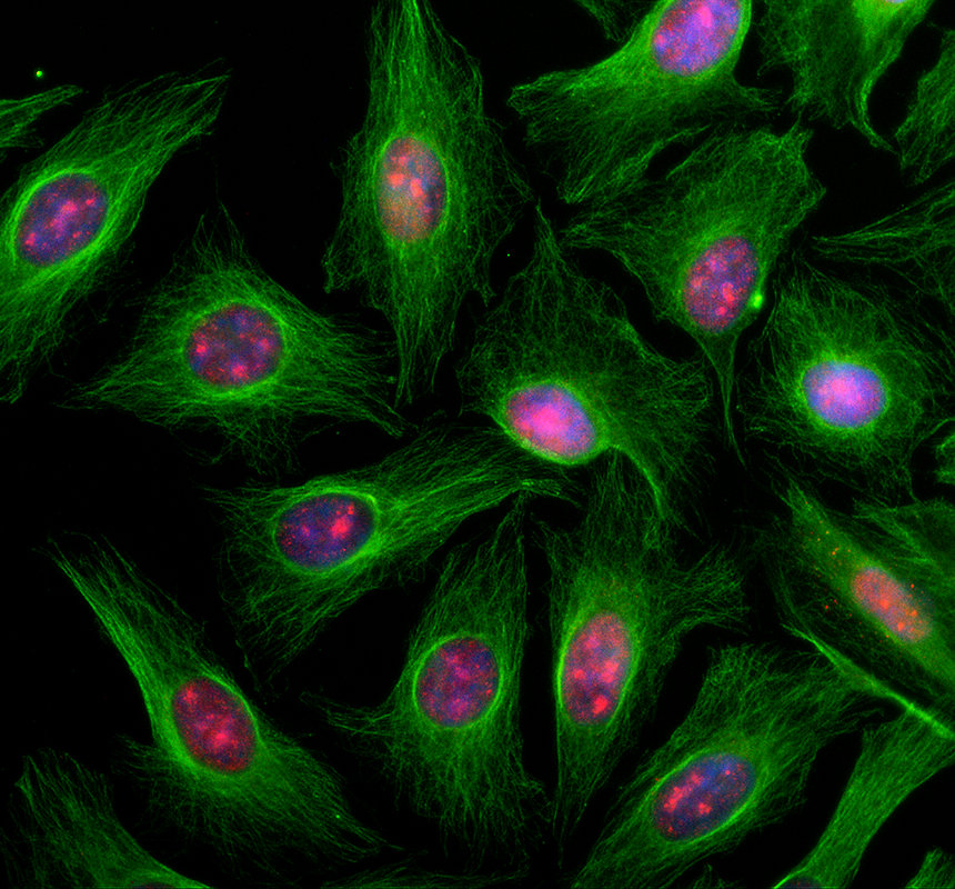 a05547 2 morf4l1 primary antibodies if testing 1