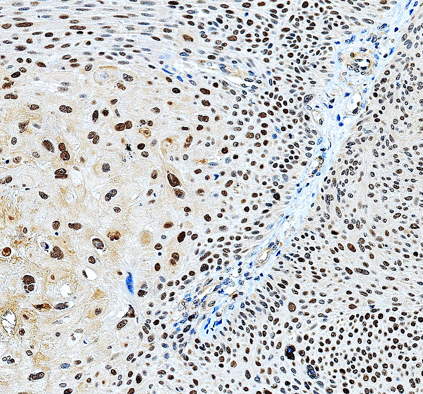 a05547 2 morf4l1 primary antibodies ihc testing 1