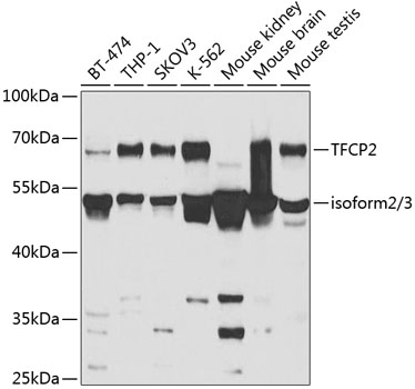 a05548 tfcp2 primary antiboties wb testing 1