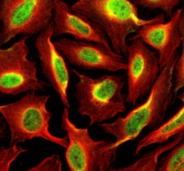 a05549 2 sipa1 primary antibodies if testing 1