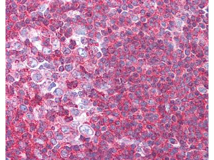 a05549 sipa1 primary antibodies ihc testing 1