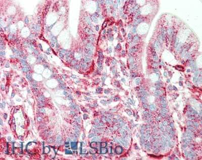 a05549 sipa1 primary antibodies ihc testing 3