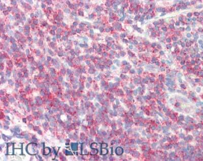 a05549 sipa1 primary antibodies ihc testing 4