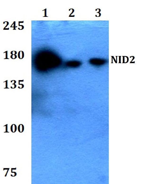 a05550 nid2 primary antiboties wb testing 1