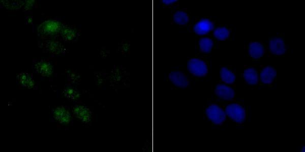 ICC staining ACTL6A in LOVO cells (green)