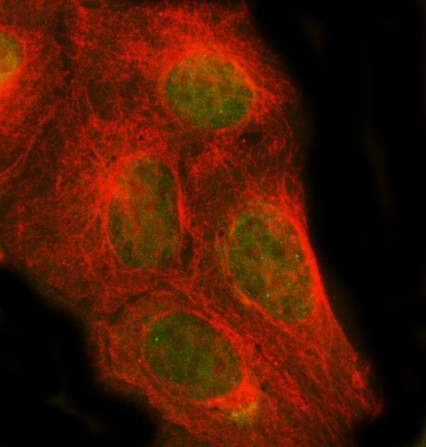  IF analysis of PSMC1 using anti-PSMC1 antibody (A05555-2) and anti-Beta Tubulin antibody (M01857-3)