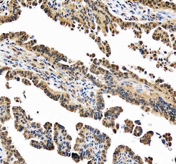 IHC analysis of PSMC1 using anti-PSMC1 antibody (A05555-2)