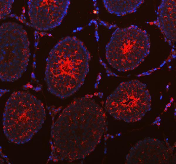 a05556 dynlt1 primary antibodies if testing 3