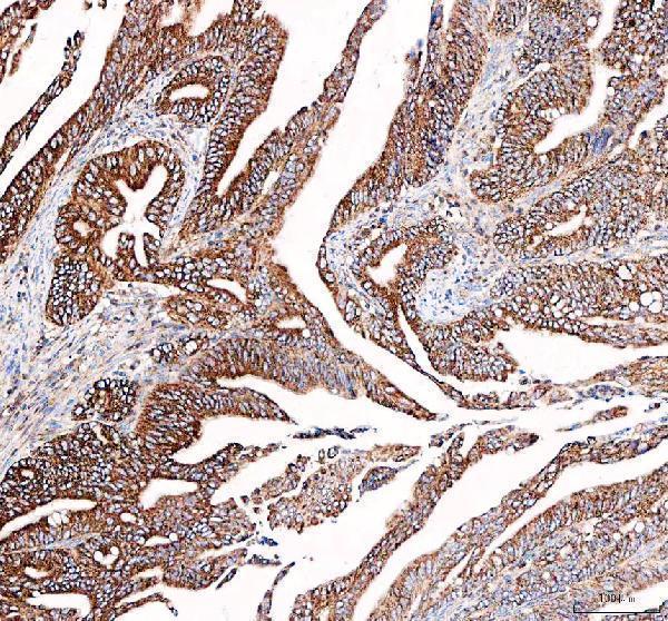 a05556 dynlt1 primary antibodies ihc testing 1